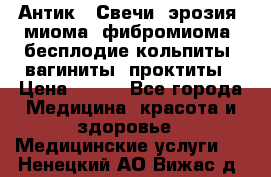 Антик.  Свечи (эрозия, миома, фибромиома, бесплодие,кольпиты, вагиниты, проктиты › Цена ­ 550 - Все города Медицина, красота и здоровье » Медицинские услуги   . Ненецкий АО,Вижас д.